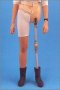 Ortopedyka protezy kończyn dolnych - zdjęcie-104599